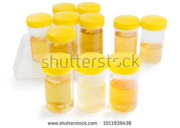 urinesamples